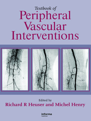 cover image of Textbook of Peripheral Vascular Interventions